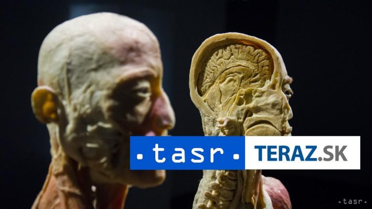 Organizátorovi výstavy ľudských tiel v Bratislave dali pokutu